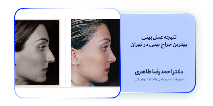 بهترین جراح بینی در تهران