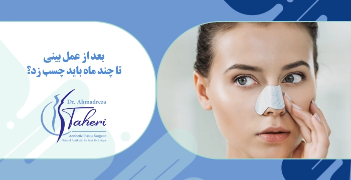بعد از عمل بینی تا چند ماه باید چسب زد؟