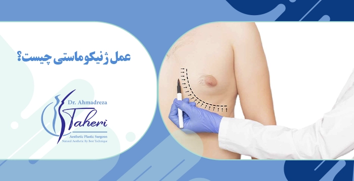عمل ژنیکوماستی چیست و چگونه انجام می‌شود؟