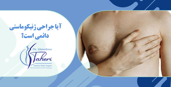 آیا بازگشت ژنیکوماستی طبیعی است؟ راه‌های پیشگیری و درمان