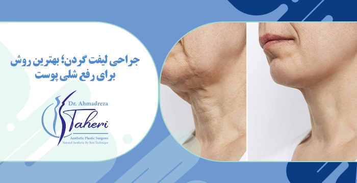 جراحی لیفت گردن؛ بهترین روش برای رفع شلی پوست