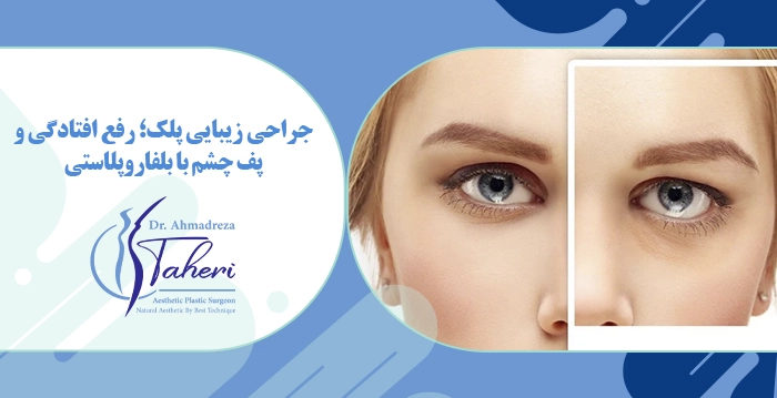جراحی زیبایی پلک؛ رفع افتادگی و پف چشم با بلفاروپلاستی