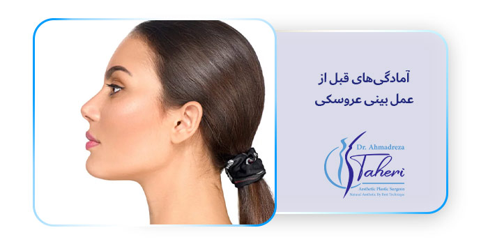 آمادگی‌های قبل از عمل بینی عروسکی