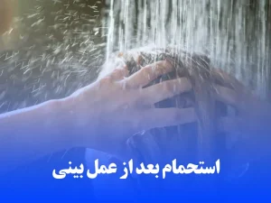 استحمام بعد از عمل بینی