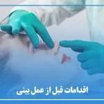 اقدامات قبل از عمل بینی