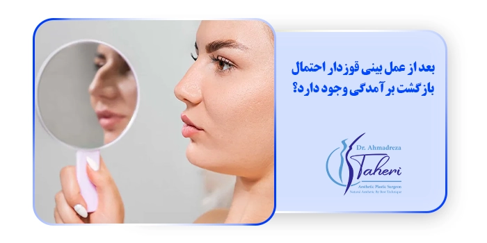 بعد از عمل بینی قوزدار احتمال بازگشت برآمدگی وجود دارد؟