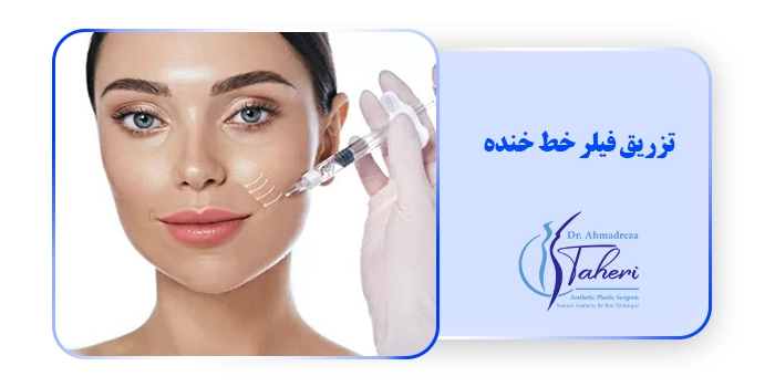 تزریق فیلر خط خنده