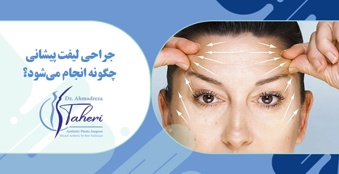 جراحی لیفت پیشانی چگونه انجام می‌شود؟