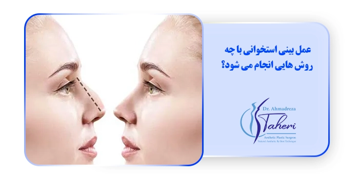 عمل بینی استخوانی با چه روش هایی انجام می شود؟