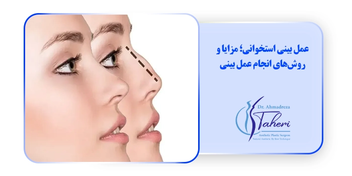 عمل بینی استخوانی؛ مزایا و روش‌های انجام عمل بینی