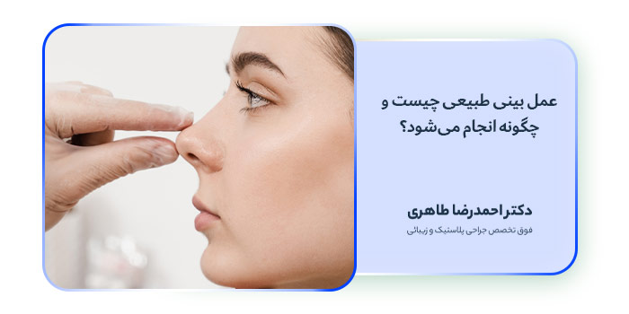 عمل بینی طبیعی چیست و چگونه انجام می‌شود؟