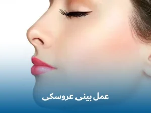 عمل بینی عروسکی