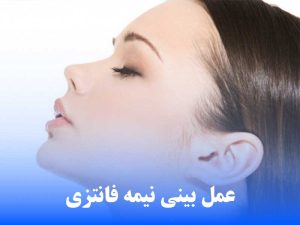عمل بینی نیمه فانتزی