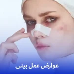 عوارض عمل بینی