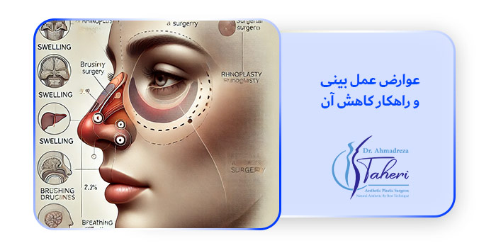 عوارض عمل بینی و راهکار کاهش آن