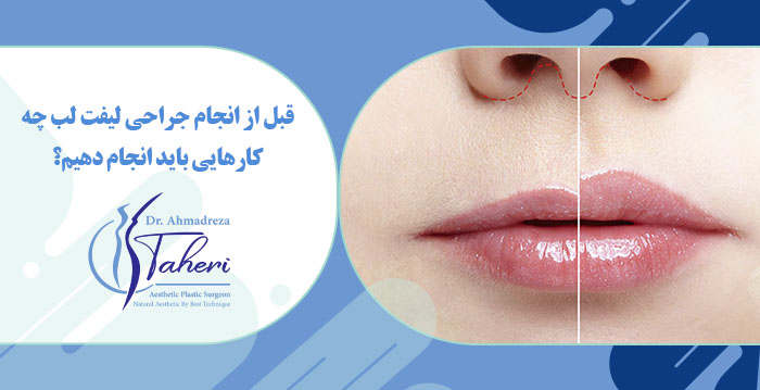 قبل از انجام جراحی لیفت لب چه کارهایی باید انجام دهیم؟