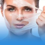 لایه برداری شیمیایی