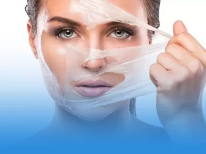 لایه برداری شیمیایی