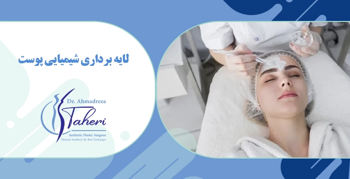 لایه برداری شیمیایی پوست