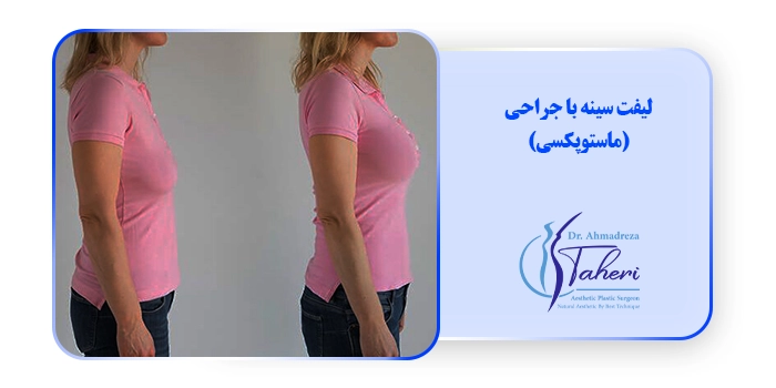 لیفت سینه با جراحی (ماستوپکسی)