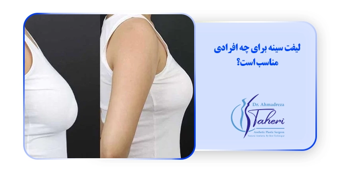 لیفت سینه برای چه افرادی مناسب است؟