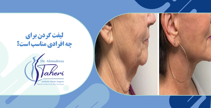 لیفت گردن برای چه افرادی مناسب است؟
