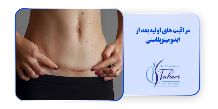 مراقبت های اولیه بعد از ابدومینوپلاستی