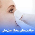 مراقبت های بعد از عمل بینی