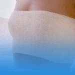 مراقبت‌های بعد از ماموپلاستی