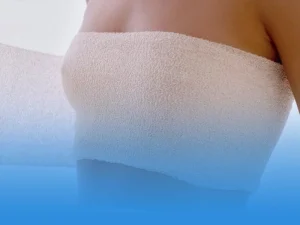 مراقبت‌های بعد از ماموپلاستی