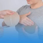 پروتز سینه