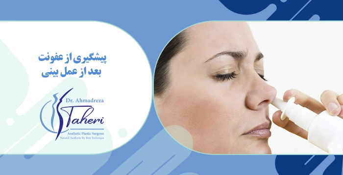 پیشگیری از عفونت بعد از عمل بینی