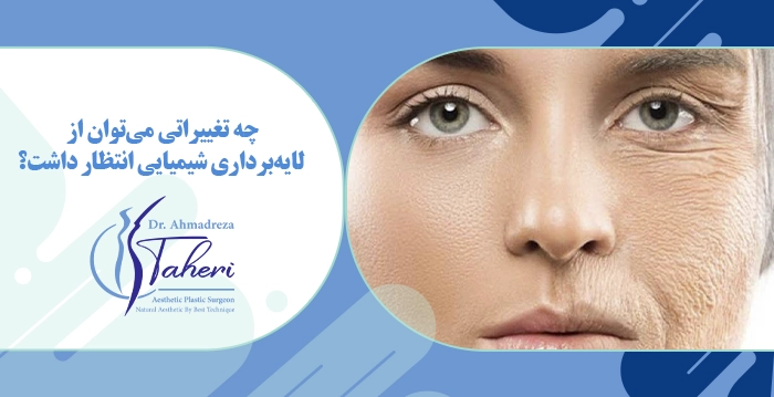 چه تغییراتی می‌توان از لایه‌برداری شیمیایی انتظار داشت؟