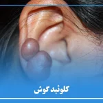 کلوئید گوش